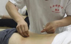 針灸初學(xué)者，你的持針手法正確嗎？