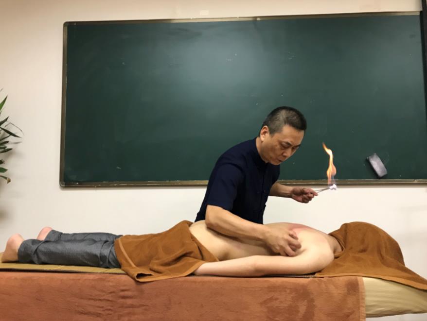 中醫(yī)可以通過拔罐辨別體質(zhì)
