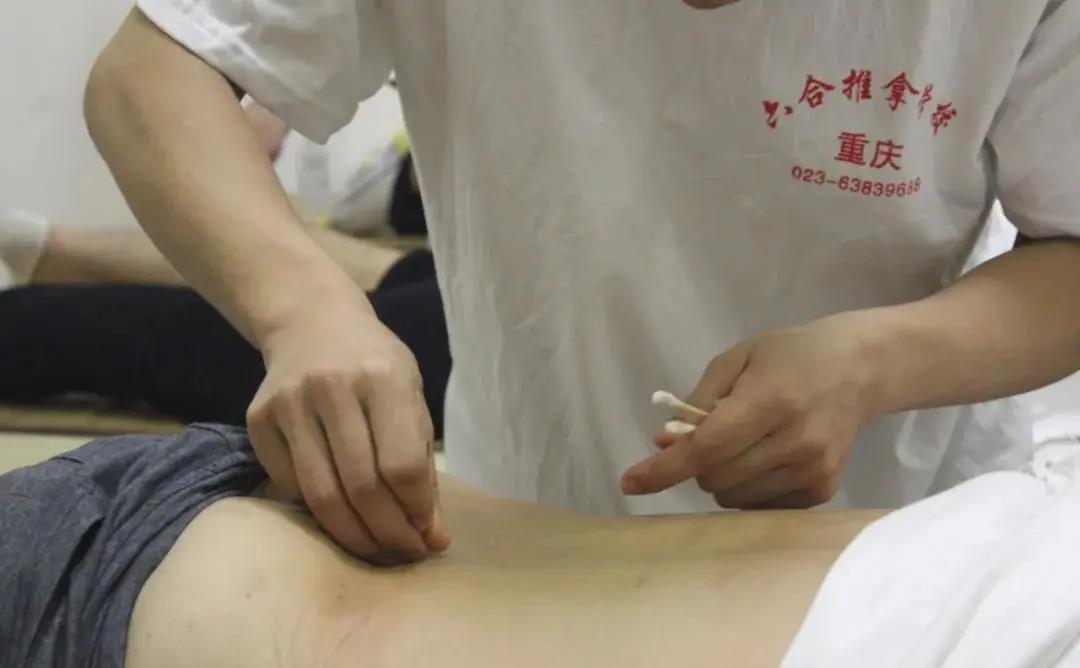 針灸真的很難嗎?一個月能學會針灸嗎?