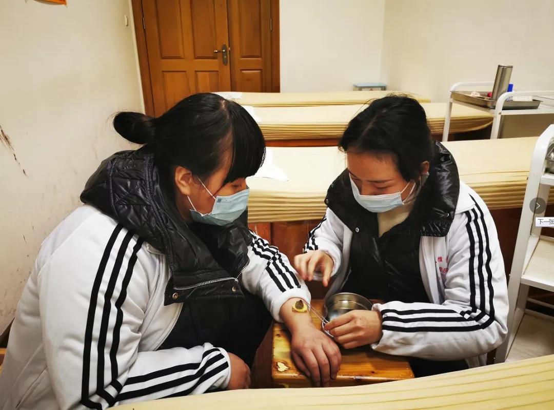 艾灸可以改善女性寒性體質(zhì)