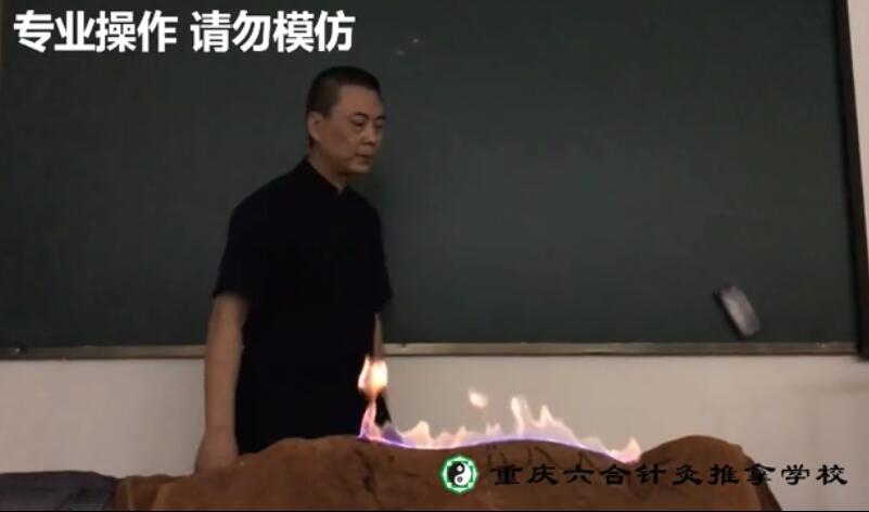 中醫(yī)火療可以起到強(qiáng)腎壯腰的作用