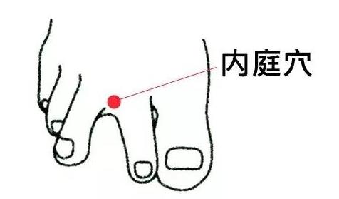 內庭穴：去胃火
